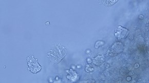 Amoebic gill disease (AGD) hos fisk