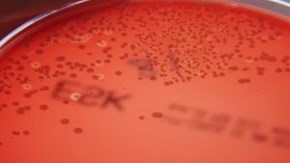 Agarplatta med bakteriekultur