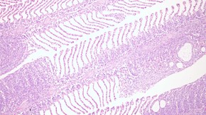 Amoebic gill disease (AGD) hos fisk